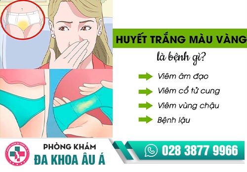 Huyết trắng có màu vàng và các vấn đề sinh sản 